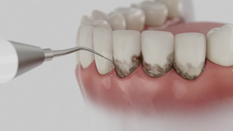 Reliable Dental contractor in Stockton University, NJ by Dentist Open Now